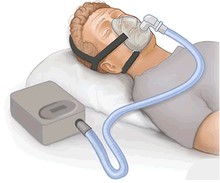 220px-CPAP